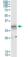 Anti-ANXA4 Rabbit Polyclonal Antibody