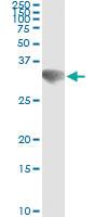 Anti-GSC Mouse Monoclonal Antibody [clone: 4H7]