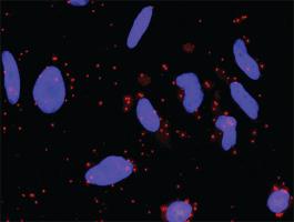 Anti-WNT5A + FZD5 Antibody Pair