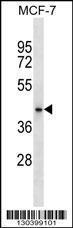 Anti-HAUS7 Rabbit Polyclonal Antibody