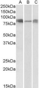 Anti-DLL4 Antibody (A83701) (0.3 µg/ml) staining of Human (A), Mouse(B) and Rat (C) Lung lysates (35 µg protein in RIPA buffer). Primary incubation was 1 hour. Detected by chemiluminescence