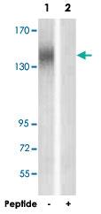 Anti-ERBB2 Rabbit Polyclonal Antibody