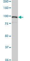 Anti-ACTN4 Mouse Monoclonal Antibody [clone: 4D10]