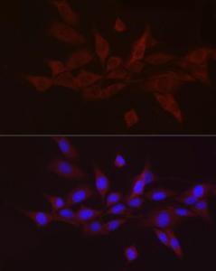 Immunofluorescence analysis of NIH/3T3 cells using Anti-GnRH Antibody (A9729) at a dilution of 1:50 (40x lens). DAPI was used to stain the cell nuclei (blue).