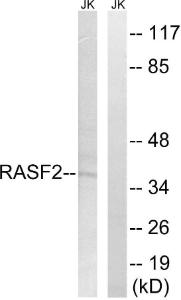 Anti-RASSF2 Rabbit Polyclonal Antibody