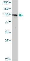 Anti-MTHFD1 Rabbit Polyclonal Antibody