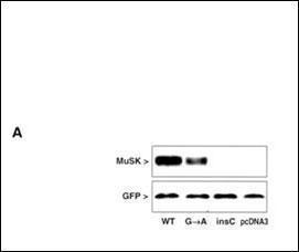 Anti-MUSK Rabbit Polyclonal Antibody (HRP (Horseradish Peroxidase))