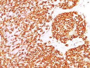 Anti-PTPRC Mouse Monoclonal Antibody [clone: PTPRC/1460]