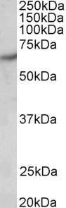 Anti-PAK1 Antibody (A83703) (0.5µg/ml) staining of Human Brain (Cerebral Cortex) lysate (35µg protein in RIPA buffer). Primary incubation was 1 hour. Detected by chemiluminescence.