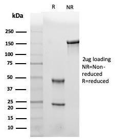 SDS-PAGE analysis of Anti-Leptin Receptor Antibody [LEPR/4301] under non-reduced and reduced conditions; showing intact IgG and intact heavy and light chains, respectively SDS-PAGE analysis confirms the integrity and purity of the antibody