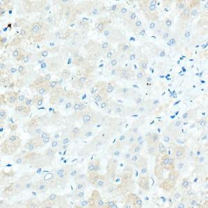 Immunohistochemistry analysis of paraffin-embedded human liver (negative control sample) using Anti-IgD Antibody [ARC2240] (A305388) at a dilution of 1:100 (40X lens). Perform high pressure antigen retrieval with 10 mM Tris/EDTA buffer pH 9.0 before commencing with IHC staining protocol