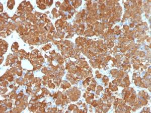 Immunohistochemical analysis of formalin-fixed, paraffin-embedded human pituitary gland using Anti-ACTH Antibody [CLIP/1407]