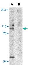 Anti-APAF1 Rabbit Polyclonal Antibody