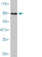 Anti-BMP7 Mouse Monoclonal Antibody [clone: M1-F8]