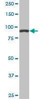 Anti-ACTN4 Mouse Monoclonal Antibody [clone: 4D10]