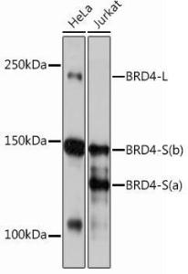 Western blot analysis of extracts of various cell lines, using Anti-Brd4 Antibody [ARC0699] (A306296) at 1:1,000 dilution The secondary antibody was Goat Anti-Rabbit IgG H&L Antibody (HRP) at 1:10,000 dilution Lysates/proteins were present at 25 µg per lane