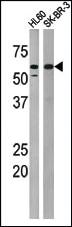 Anti-MYT1 Rabbit Polyclonal Antibody