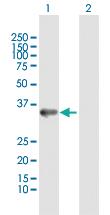 Anti-ANXA4 Rabbit Polyclonal Antibody