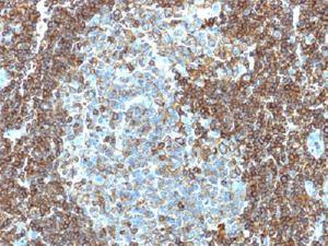 Anti-CD3E Mouse Monoclonal Antibody [clone: PC3/188A]