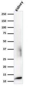 Western blot analysis of human kidney tissue lysate using Anti-beta 2 Microglobulin Antibody [rB2M/961]