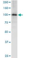 Anti-MTHFD1 Rabbit Polyclonal Antibody