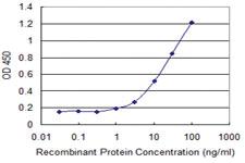 Anti-CCDC115 Mouse Monoclonal Antibody [clone: 4E9]