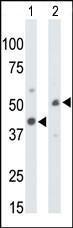 Anti-CKMT1A Rabbit polyclonal antibody