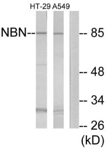 Western blot analysis of lysates from A549 and HT-29 cells using Anti-NBN Antibody. The right hand lane represents a negative control, where the antibody is blocked by the immunising peptide