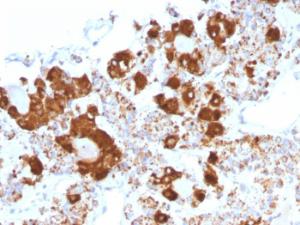 Immunohistochemical analysis of formalin-fixed, paraffin-embedded human pituitary using Anti-ACTH Antibody [CLIP/1407]