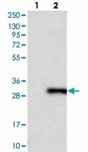 Anti-RAB14 Rabbit Polyclonal Antibody