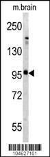 Anti-GRM5 Rabbit Polyclonal Antibody (PE (Phycoerythrin))