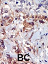 Anti-PIP4K2A Rabbit Polyclonal Antibody (HRP (Horseradish Peroxidase))