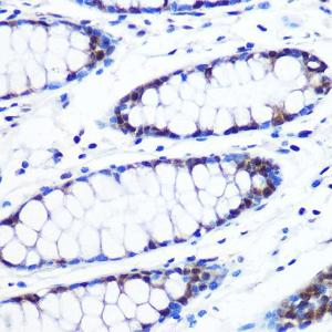 Immunohistochemistry analysis of paraffin-embedded human colon tissue using Anti-Brd4 Antibody [ARC0699] (A306296) at a dilution of 1:100 (40x lens) Perform microwave antigen retrieval with 10 mM PBS buffer pH 72 before commencing with IHC staining protocol