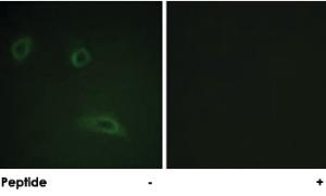 Anti-ERBB2 Rabbit Polyclonal Antibody