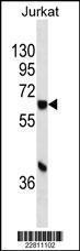 Anti-CYP1A1 Mouse Monoclonal Antibody (AP (Alkaline Phosphatase)) [clone: 655CT6.1.2]