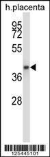 Anti-GNAQ Rabbit Polyclonal Antibody (PE (Phycoerythrin))