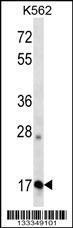 Anti-APOO Rabbit Polyclonal Antibody (APC (Allophycocyanin))