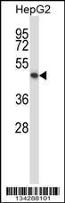 Anti-KCNK10 Rabbit Polyclonal Antibody (AP (Alkaline Phosphatase))