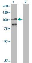 Anti-ACTN4 Mouse Monoclonal Antibody [clone: 4D10]