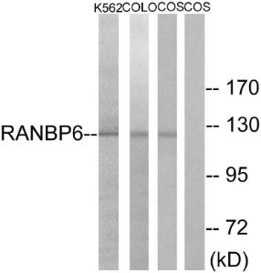 Western blot analysis of lysates from COS7, K56 and COLO cells using Anti-RANBP6 Antibody The right hand lane represents a negative control, where the antibody is blocked by the immunising peptide