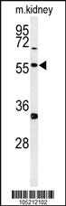 Anti-NFKB Rabbit Polyclonal Antibody