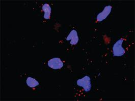 Anti-FGF5 + EGF Antibody Pair