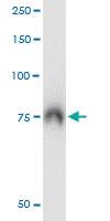 Anti-ABCF2 Mouse Monoclonal Antibody