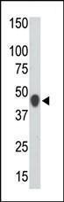 Anti-CKMT2 Rabbit Polyclonal Antibody (Biotin)