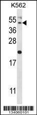 Anti-HAVCR1 Rabbit Polyclonal Antibody (APC (Allophycocyanin))