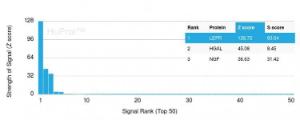 Analysis of protein array containing more than 19,000 full-length human proteins using Anti-Leptin Receptor Antibody [LEPR/4301] Z-Score and S- Score