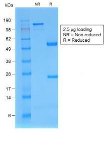 SDS-PAGE analysis of Anti-beta 2 Microglobulin Antibody [rB2M/961] under non-reduced and reduced conditions; showing intact IgG and intact heavy and light chains, respectively. SDS-PAGE analysis confirms the integrity and purity of the Antibody