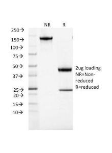 SDS-PAGE analysis of Anti-ACTH Antibody [CLIP/1407] under non-reduced and reduced conditions; showing intact IgG and intact heavy and light chains, respectively SDS-PAGE analysis confirms the integrity and purity of the antibody