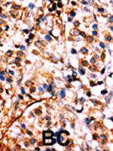 Anti-NFKB Rabbit Polyclonal Antibody