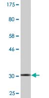 Anti-S100 P Mouse Monoclonal Antibody [clone: 1A11]